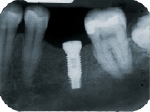 iStock_000004365410XSmall1.jpg