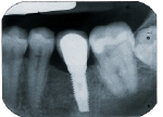 iStock_000004365410XSmall.jpg